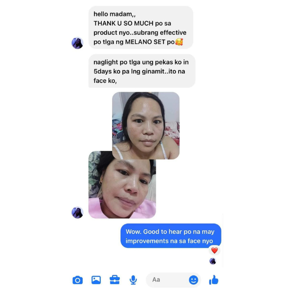 Melano Whitening Set – Complete Skin Brightening & Dark Spot Removal Solution | (Feedback in Pictures)